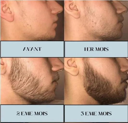 Huile Accélératrice de Pousse pour Barbe_avant_apres